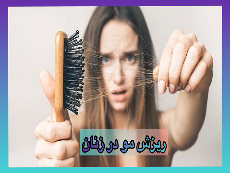 ریزش مو در زنان